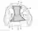 Fig. 01 - HIGHLY ABSORBENT RESISTANT WASHABLE AND REUSABLE UNDERGARMENTS, METHODS OF USE, KITS AND USES THERETO