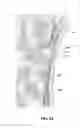 Fig. 04 - HIGHLY ABSORBENT RESISTANT WASHABLE AND REUSABLE UNDERGARMENTS, METHODS OF USE, KITS AND USES THERETO