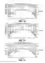 Fig. 08 - Method for maintaining sterile surgical instruments sterile in surgery