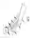 Fig. 12 - Method for maintaining sterile surgical instruments sterile in surgery