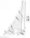 Fig. 14 - Method for maintaining sterile surgical instruments sterile in surgery