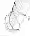 Fig. 17 - Method for maintaining sterile surgical instruments sterile in surgery