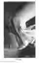 Fig. 09 - Method, system and apparatus for treating myofascial and musculoskeletal tissue imbalances using a soft tissue mobilizing device that can be manually lifted and shifted for normalizing myofascial and musculoskeletal tissue imbalances