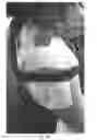 Fig. 11 - Method, system and apparatus for treating myofascial and musculoskeletal tissue imbalances using a soft tissue mobilizing device that can be manually lifted and shifted for normalizing myofascial and musculoskeletal tissue imbalances