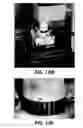 Fig. 15 - Systems and methods for regulation of one or more cutaneous proteins