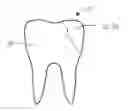 Fig. 01 - Dental Restoration Putty and Method of Formulating and Applying