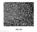 Fig. 11 - Timed release of substances to treat ocular disorders