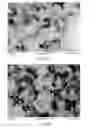 Fig. 27 - Timed release of substances to treat ocular disorders