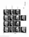 Fig. 19 - Carrier-antibody compositions and methods of making and using the same