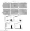 Fig. 13 - Methods and compositions for treating kidney disorders