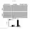 Fig. 22 - Methods and compositions for treating kidney disorders