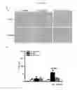 Fig. 38 - Methods and compositions for treating kidney disorders