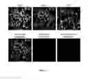Fig. 09 - Methods for inhibiting mesenchymal phenotype after epithelial-to-mesenchymal transition