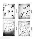 Fig. 07 - Method for isolation and purification of microvesicles from cell culture supernatants and biological fluids