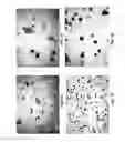 Fig. 08 - Method for isolation and purification of microvesicles from cell culture supernatants and biological fluids