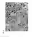 Fig. 17 - Compositions comprising stem cells expressing mesenchymal and neuronal markers and uses thereof to treat neurological disease