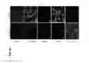 Fig. 27 - Compositions comprising stem cells expressing mesenchymal and neuronal markers and uses thereof to treat neurological disease