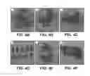Fig. 06 - UMBILICAL CORD AMNIOTIC MEMBRANE PRODUCTS