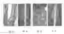 Fig. 03 - Systems and methods for improved delivery of osteoinductive molecules in bone repair
