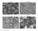 Fig. 13 - Systems and methods for improved delivery of osteoinductive molecules in bone repair