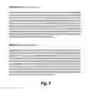 Fig. 05 - TREATMENT OF GRAFT REJECTION BY ADMINISTERING A COMPLEMENT INHIBITOR TO AN ORGAN PRIOR TO TRANSPLANT