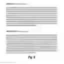 Fig. 07 - TREATMENT OF GRAFT REJECTION BY ADMINISTERING A COMPLEMENT INHIBITOR TO AN ORGAN PRIOR TO TRANSPLANT