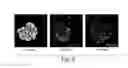 Fig. 07 - Treatment of chronic nephropathies using soluble complement receptor type I (sCR1)