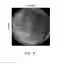 Fig. 09 - Adeno-associated virus virions with variant capsid and methods of use thereof