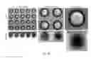 Fig. 20 - Method to functionalize cells in human blood, other fluids and tissues using nanoparticles