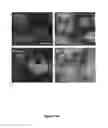 Fig. 27 - Methods and compositions for inhibiting diseases of the central nervous system
