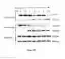 Fig. 87 - Methods and compositions for inhibiting diseases of the central nervous system