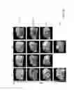 Fig. 19 - Carrier-antibody compositions and methods of making and using the same