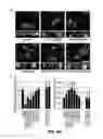 Fig. 14 - RAB7L1 INTERACTS WITH LRRK2 TO MODIFY INTRANEURONAL PROTEIN SORTING AND PARKINSON'S DISEASE RISK