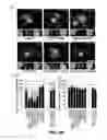 Fig. 15 - RAB7L1 INTERACTS WITH LRRK2 TO MODIFY INTRANEURONAL PROTEIN SORTING AND PARKINSON'S DISEASE RISK