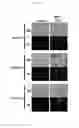 Fig. 13 - CANCER CELL SPECIFIC IMAGING PROBES AND METHODS OF USE