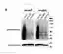 Fig. 33 - CANCER CELL SPECIFIC IMAGING PROBES AND METHODS OF USE