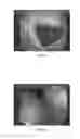 Fig. 02 - Solid composition for the oral administration of dyes and diagnostic use thereof
