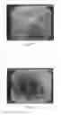 Fig. 03 - Solid composition for the oral administration of dyes and diagnostic use thereof