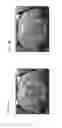 Fig. 04 - Functionalized magnetic nanoparticles and use in imaging amyloid deposits and neurofibrillary tangles