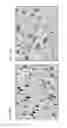 Fig. 07 - Functionalized magnetic nanoparticles and use in imaging amyloid deposits and neurofibrillary tangles