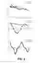 Fig. 05 - Hyperpolarized lactate contrast agent for determination of LDH activity