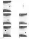 Fig. 04 - Traceable devices for gastrointestinal use and methods of use and manufacturing the same