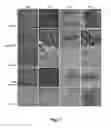 Fig. 08 - Solubilization of antigen components for removal from tissues