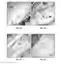 Fig. 12 - Platelet-derived growth factor compositions and methods for the treatment of tendon and ligament injuries