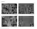 Fig. 18 - Platelet-derived growth factor compositions and methods for the treatment of tendon and ligament injuries