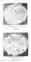 Fig. 02 - Porous biocompatible polymer material and methods