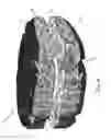 Fig. 09 - Porous biocompatible polymer material and methods