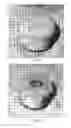 Fig. 21 - Porous biocompatible polymer material and methods