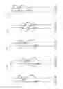Fig. 15 - CATHETER PUMP ASSEMBLY INCLUDING A STATOR