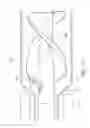 Fig. 19 - CATHETER PUMP ASSEMBLY INCLUDING A STATOR